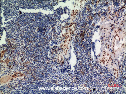 Immunohistochemistry of paraffin-embedded Human tonsil tissue using ERK 1 Monoclonal Antibody at dilution of 1:200.
