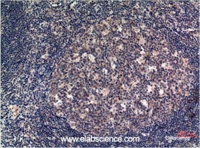 Immunohistochemistry of paraffin-embedded Human tonsil tissue using MLKL Monoclonal Antibody at dilution of 1:200.