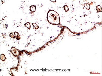 Immunohistochemistry of paraffin-embedded Rat skin tissue using PDGFRA Monoclonal Antibody at dilution of 1:200.