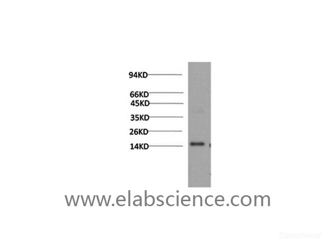 Western Blot analysis of Human serum using TTR Monoclonal Antibody at dilution of 1:2000.