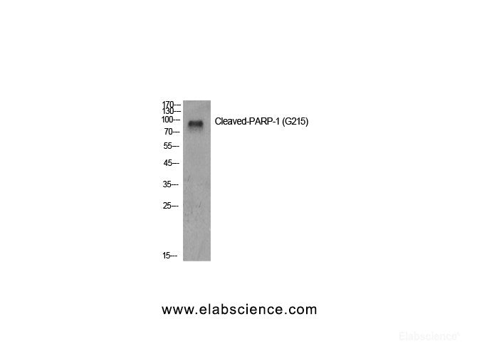 Western Blot analysis of Jurkat cells using Cleaved-PARP1 (G215) Polyclonal Antibody at dilution of 1:500.