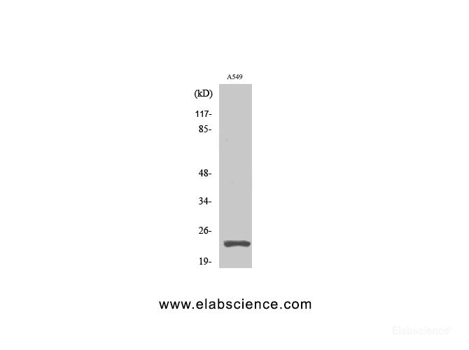 Western Blot analysis of A549 cells using Cleaved-PARP1 (D214) Polyclonal Antibody at dilution of 1:2000.
