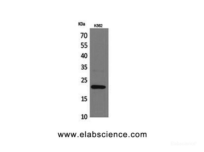 Western Blot analysis of K562 cells using IL6 Polyclonal Antibody at dilution of 1:1000.