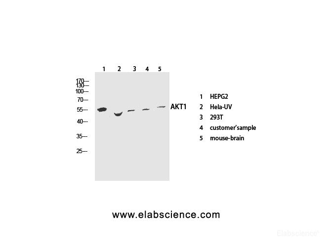 Western Blot analysis of various cells using Pan-Akt Polyclonal Antibody at dilution of 1:1000.