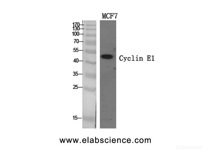 Western Blot analysis of MCF7 cells using Cyclin E1 Polyclonal Antibody at dilution of 1:500.