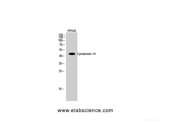 Western Blot analysis of HY926 cells using CK-19 Polyclonal Antibody at dilution of 1:1000.
