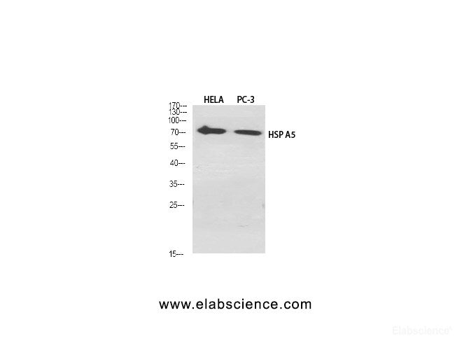 Western Blot analysis of Hela, PC-3 cells using HSPA5 Polyclonal Antibody at dilution of 1:2000.