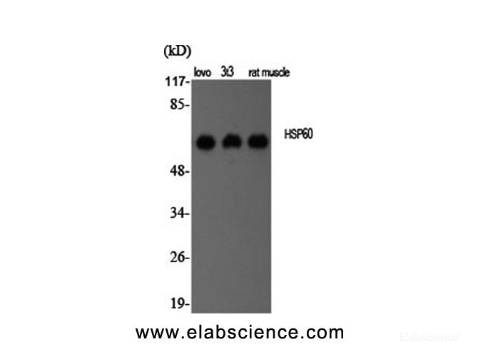 Western Blot analysis of various cells using HSP60 Polyclonal Antibody at dilution of 1:2000.