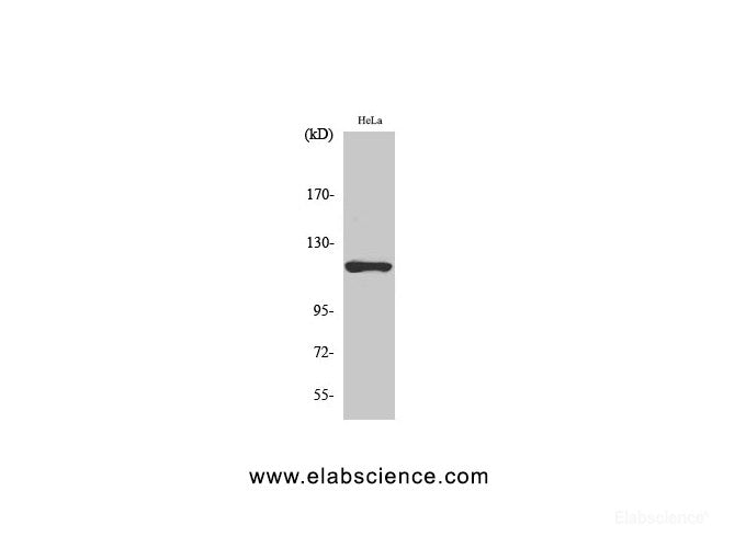 Western Blot analysis of Hela cells using HK1 Polyclonal Antibody at dilution of 1:1000.