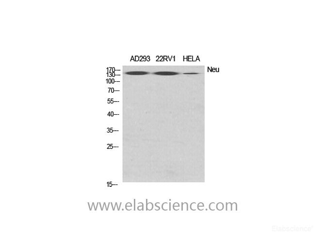 Western Blot analysis of various cells using ERBB2 Polyclonal Antibody at dilution of 1:2000.