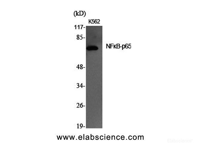 Western Blot analysis of K562 cells using NFκB-p65 Polyclonal Antibody at dilution of 1:2000.