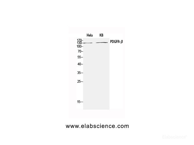 Western Blot analysis of Hela, KB cells using PDGFRB Polyclonal Antibody at dilution of 1:1000.
