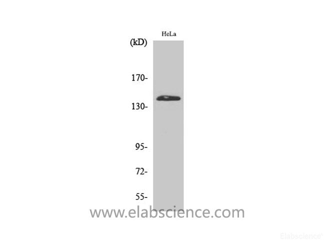 Western Blot analysis of Hela cells using PERK Polyclonal Antibody at dilution of 1:2000.