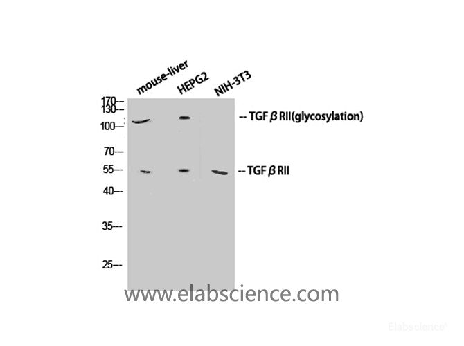Western Blot analysis of various cells using TGF β Receptor II Polyclonal Antibody at dilution of 1:1000.