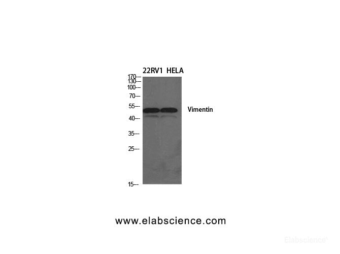 Western Blot analysis of 22RV1, Hela cells using Vimentin Polyclonal Antibody at dilution of 1:1000.