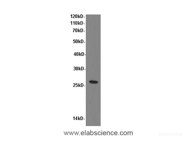 Western Blot analysis of Mouse kidney tissue using TNF alpha Polyclonal Antibody at dilution of 1:600