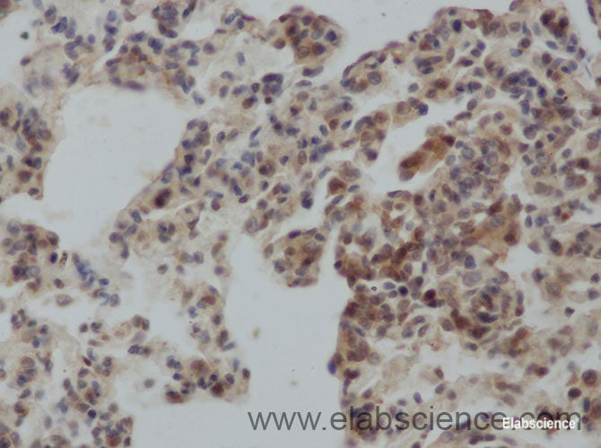 Immunohistochemistry of paraffin-embedded Rat lung using IL2 Polyclonal Antibody at dilution of 1:50