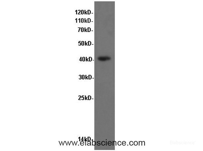 Western Blot analysis of NIH/3T3 cells using P38 Polyclonal Antibody at dilution of 1:600