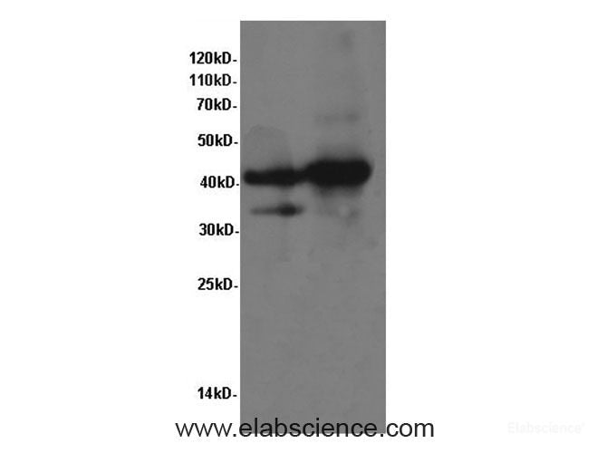 Western Blot analysis of Rat heart and Mouse heart tissue using TNNT2 Polyclonal Antibody at dilution of 1:600