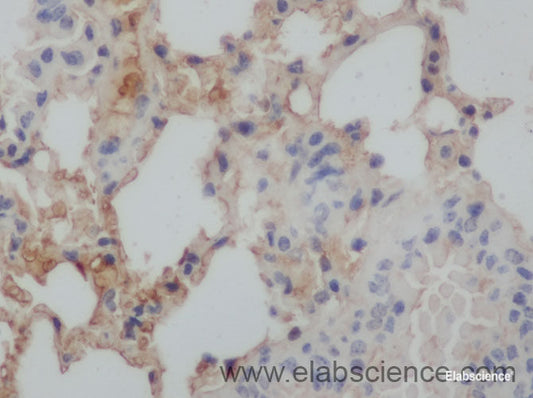 Immunohistochemistry of paraffin-embedded Rat lung using Aβ40 Polyclonal Antibody at dilution of 1:50