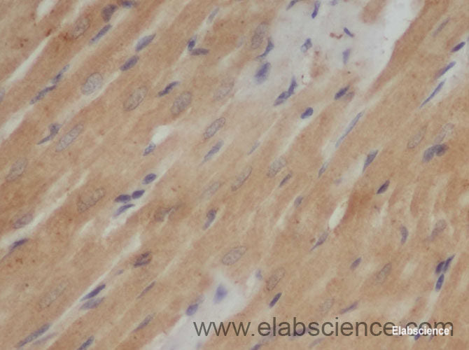 Immunohistochemistry of paraffin-embedded Rat heart using AB42 Polyclonal Antibody at dilution of 1:50