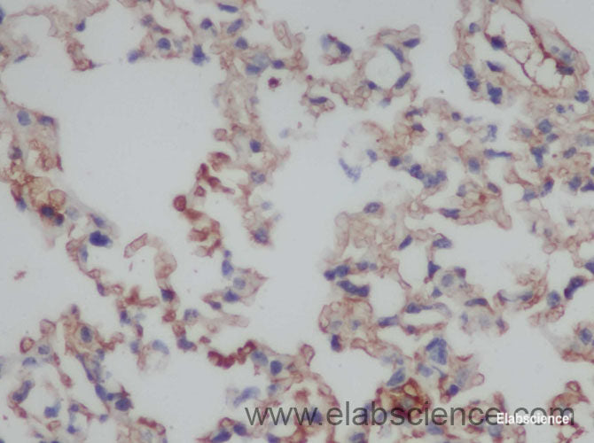 Immunohistochemistry of paraffin-embedded Rat lung using IFNG Polyclonal Antibody at dilution of 1:50