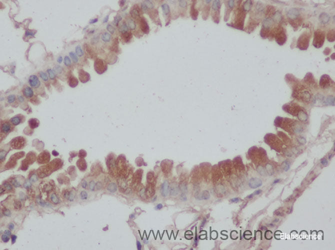 Immunohistochemistry of paraffin-embedded Rat lung using DNAL1 Polyclonal Antibody at dilution of 1:50