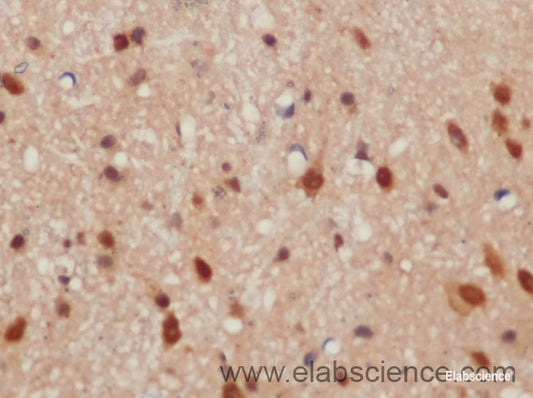 Immunohistochemistry of paraffin-embedded Mouse brain using CXCL14 Polyclonal Antibody at dilution of 1:50