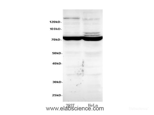 Western bot analysis of HeLa and 293T cells using SDHA Polyclonal Antibody at dilution of 1:600