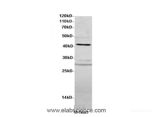 Western Blot analysis of Mouse heart using ACTA2 Polyclonal Antibody at dilution of 1:600