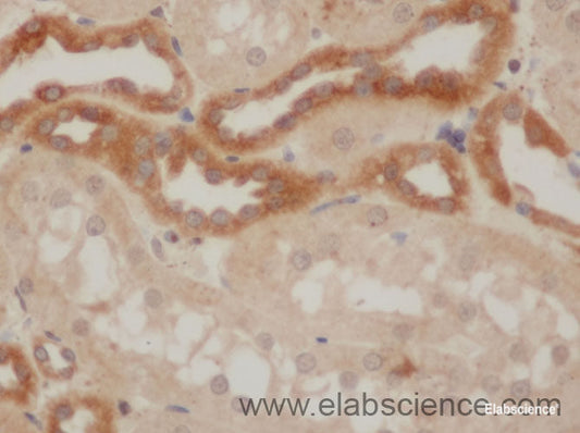 Immunohistochemistry of paraffin-embedded Rat kidney using IkB alpha Polyclonal Antibody at dilution of 1:50