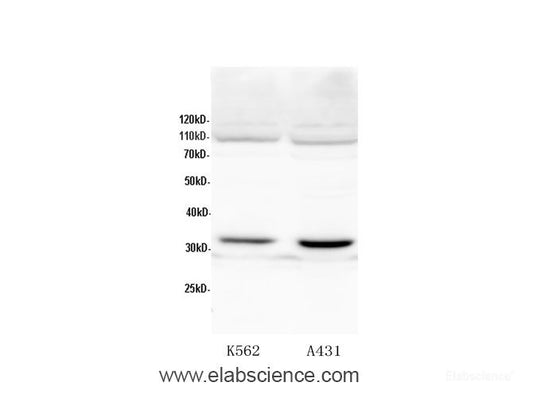 Western Blot analysis of K562 and A431 cells using CDK2 Polyclonal Antibody at dilution of 1:600