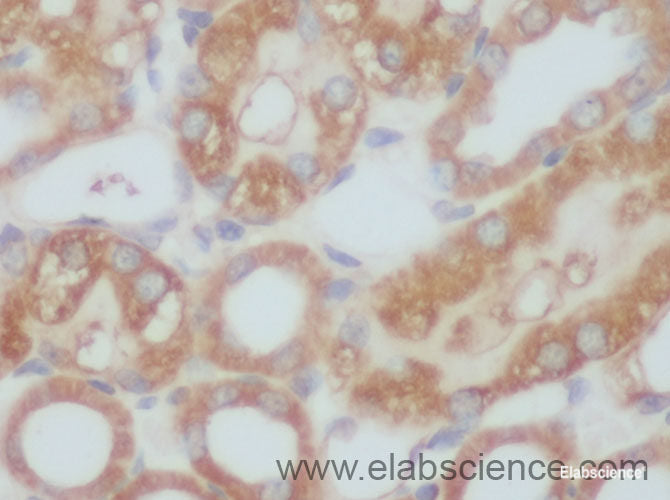 Immunohistochemistry of paraffin-embedded Rat kidney using Vimentin Polyclonal Antibody at dilution of 1:50