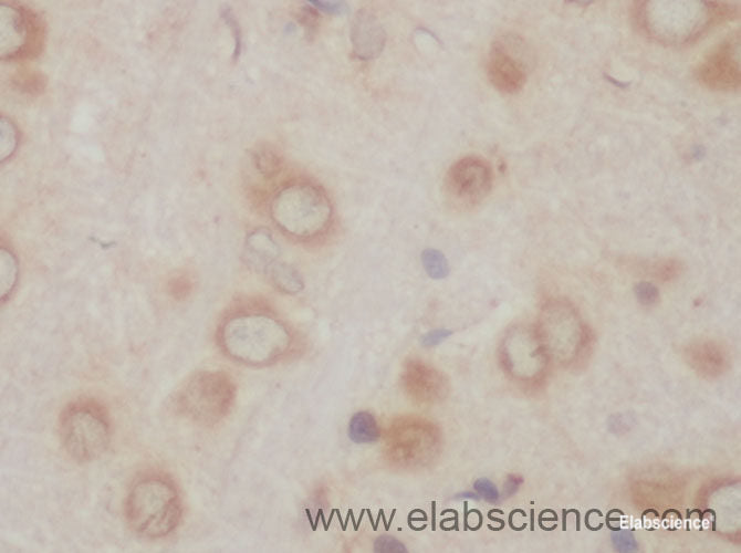 Immunohistochemistry of paraffin-embedded Rat brain using ACSBG1 Polyclonal Antibody at dilution of 1:50