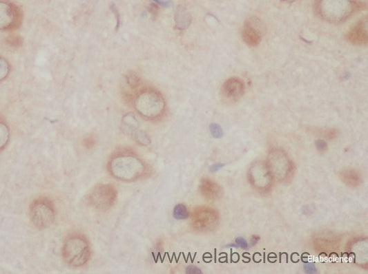 Immunohistochemistry of paraffin-embedded Rat brain using ACSBG1 Polyclonal Antibody at dilution of 1:50