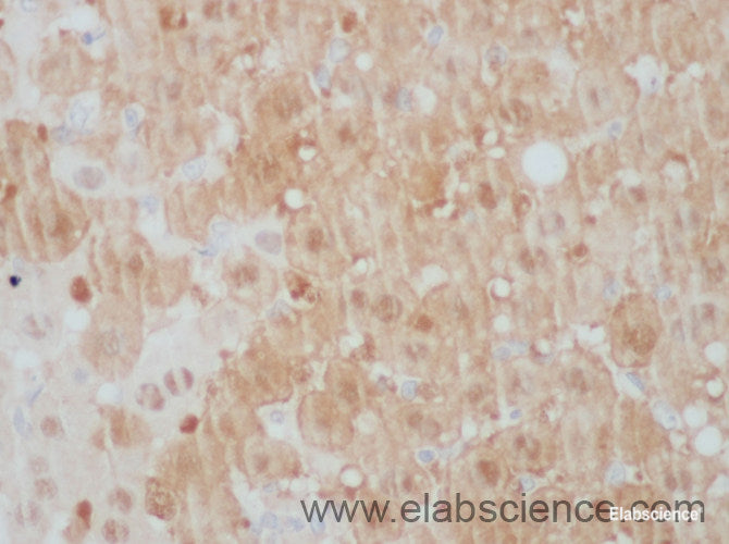 Immunohistochemistry of paraffin-embedded Mouse liver using ARG2 Polyclonal Antibody at dilution of 1:50