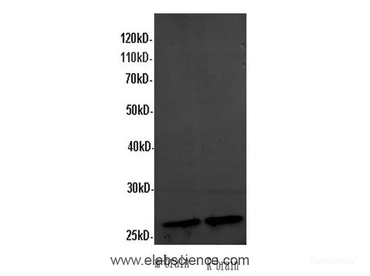 Western Blot analysis of Mouse brain and Rat brain using ANXA5 Polyclonal Antibody at dilution of 1:600