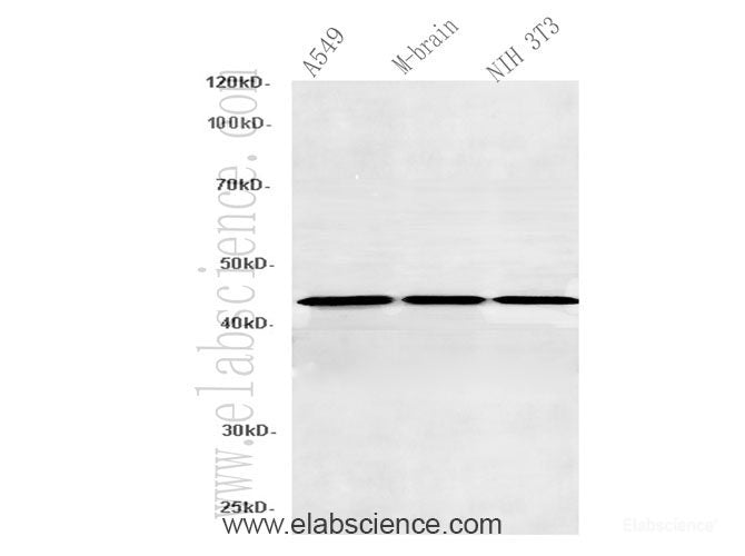 Western Blot analysis of A549, Mouse brain and NIH3T3 using SEPT5 Polyclonal Antibody at dilution of 1:600