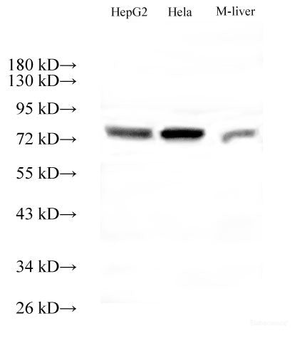 Western Blot analysis of HepG2, Hela cells and Mouse liver tissue using ACTN4 Polyclonal Antibody at dilution of 1:500