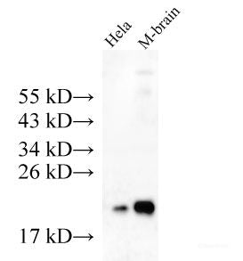 Western Blot analysis of Hela cells and Mouse brain tissue using KRAS Polyclonal Antibody at dilution of 1:500