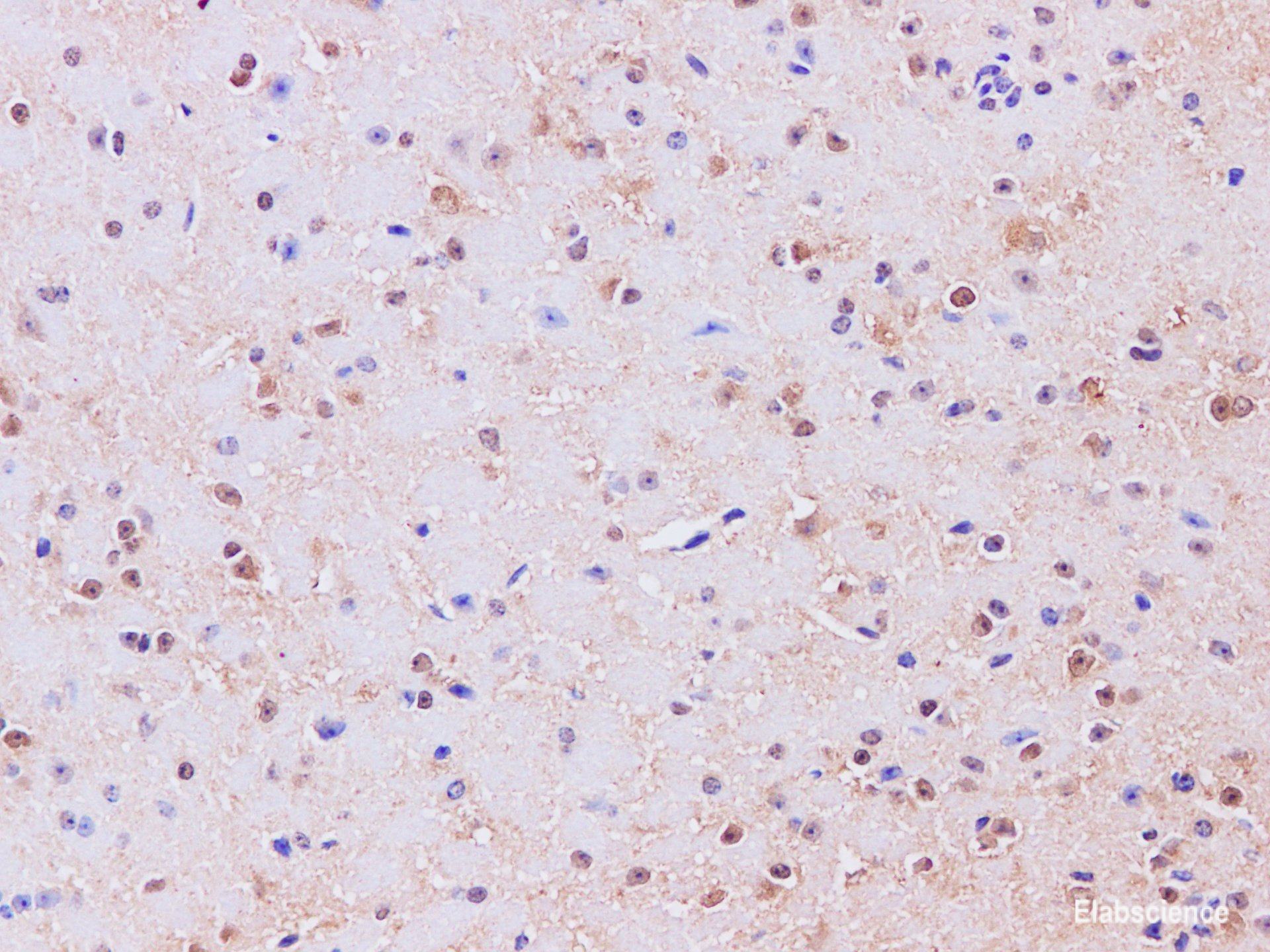 Immunohistochemistry of paraffin-embedded Mouse brain using GAD1 Polyclonal Antibody at dilution of 1:200