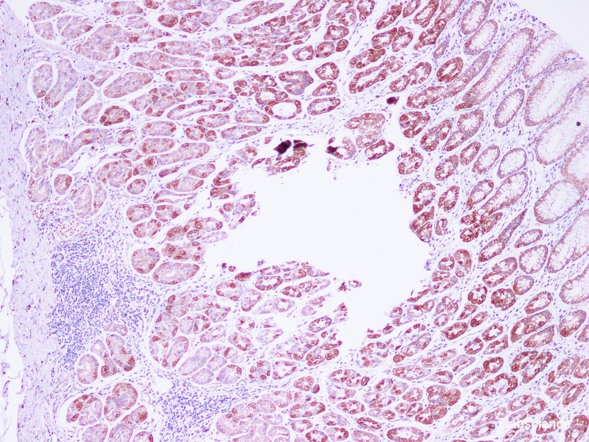 Immunohistochemistry of paraffin-embedded Human stomach using IHH Polyclonal Antibody at dilution of 1:100(100×)