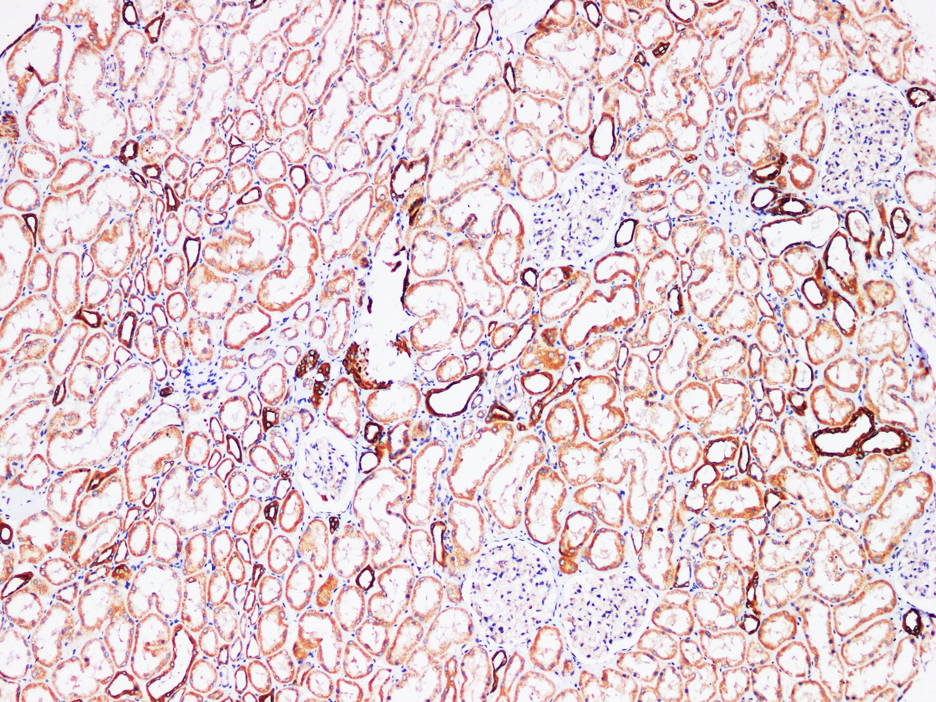 Immunohistochemistry of paraffin-embedded Human kidney using FUT3 Polyclonl Antibody at dilution of 1:200.