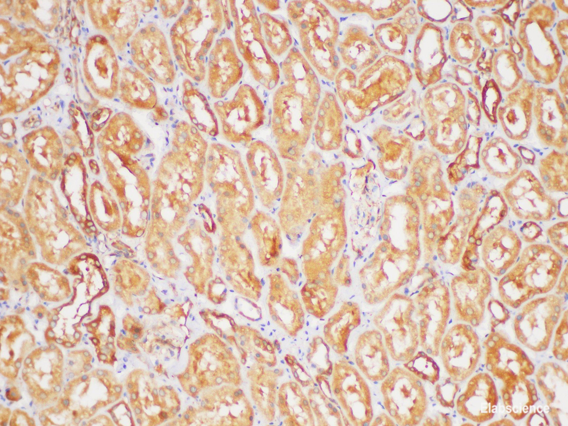 Immunohistochemistry of paraffin-embedded Human kidney using TGFB2 Polycloanl Antibody at dilution of 1:200