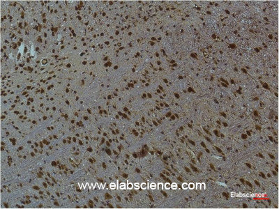 Immunohistochemistry of paraffin-embedded Mouse brain tissue using Phospho-CAMK2 beta/gamma/delta (Thr287) Monoclonal Antibody at dilution of 1:200
