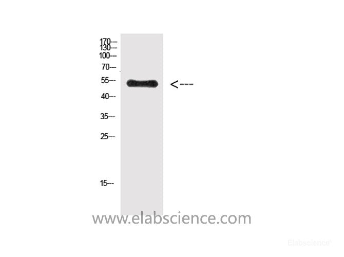 Western Blot analysis of Hela cells using Phospho-Vimentin (Tyr38) Polyclonal Antibody at dilution of 1:500.