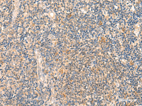 Immunohistochemistry of paraffin-embedded Human tonsil tissue  using HSPA4L Polyclonal Antibody at dilution of 1:30(×200)