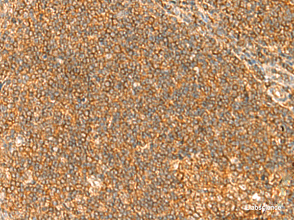 Immunohistochemistry of paraffin-embedded Human tonsil tissue  using TBCK Polyclonal Antibody at dilution of 1:40(×200)