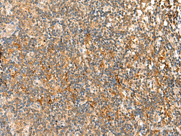 Immunohistochemistry of paraffin-embedded Human tonsil tissue  using HTT Polyclonal Antibody at dilution of 1:30(×200)