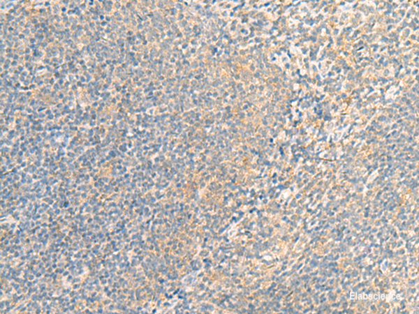 Immunohistochemistry of paraffin-embedded Human tonsil tissue  using IFNA5 Polyclonal Antibody at dilution of 1:35(×200)